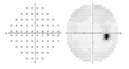 eye exam for plaquenil