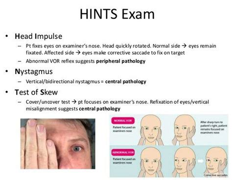 neurological exam eye tracking