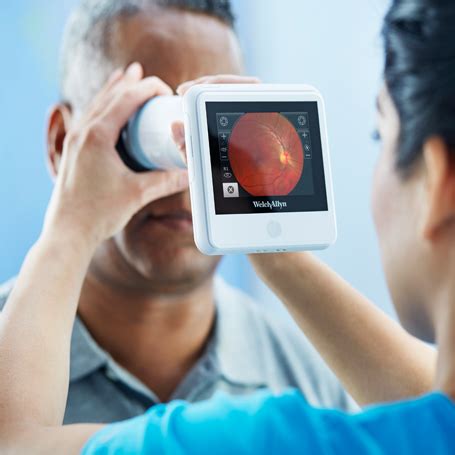 retinavue eye exam