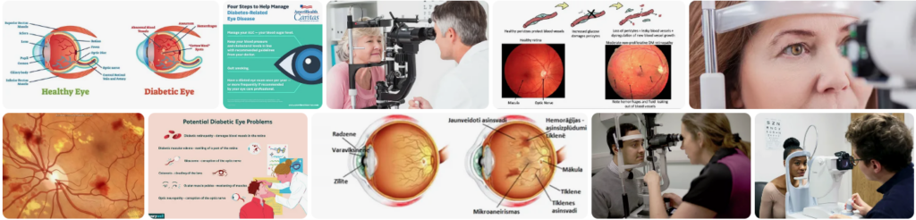 AOA Diabetic Eye Exam Report